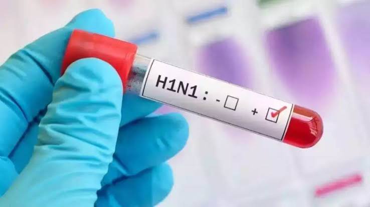 CG News: छत्तीसगढ़ में स्वाइन फ्लू के 205 मामले, 24 घंटे में 26 नए मरीज, कोरोना ने भी बढ़ाई चिंता